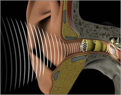 The Lyric Device hearing aid at Ear Associates